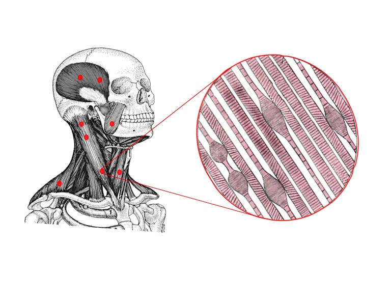 Patologia articolare e dolore miofacciale nei DCM